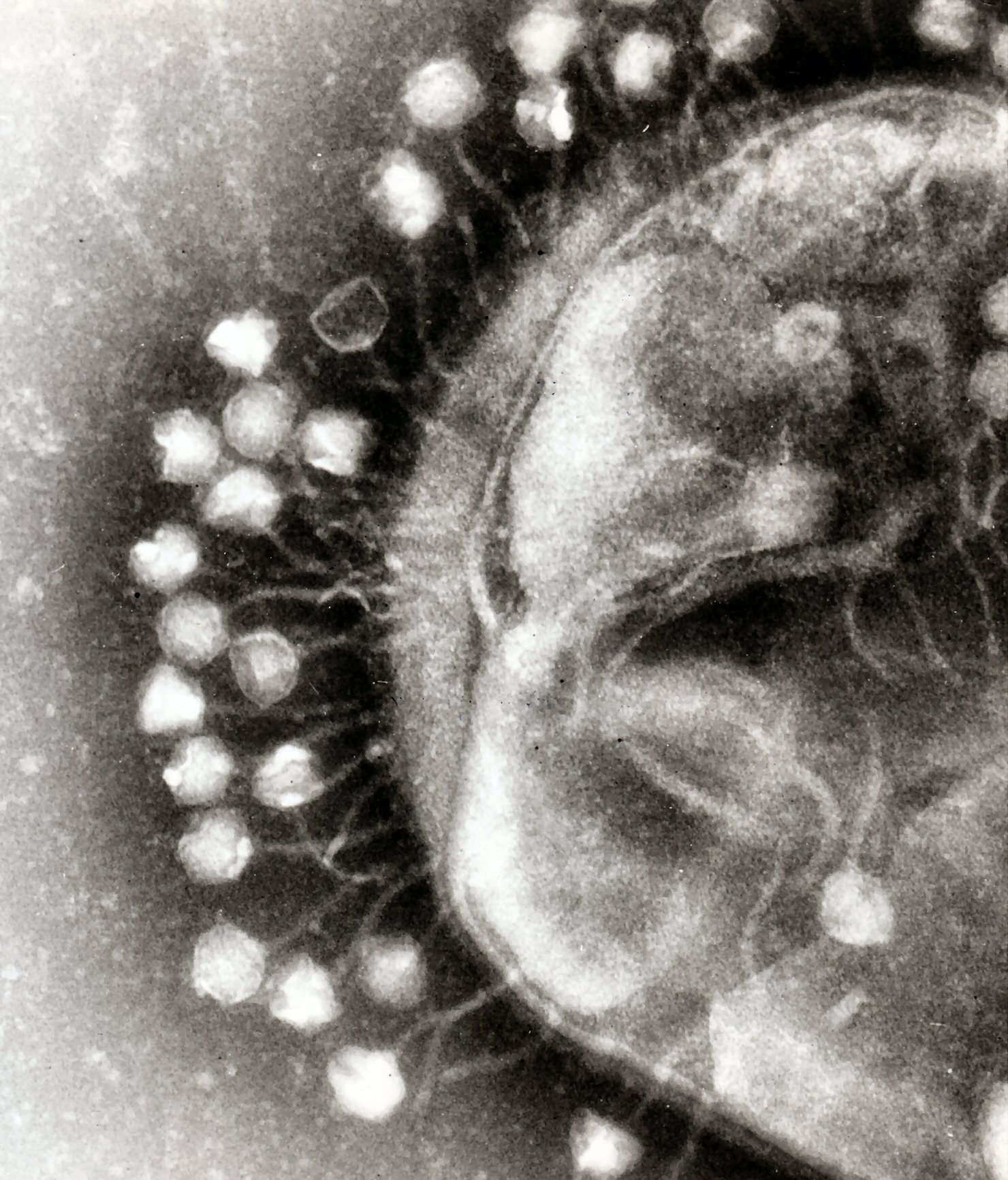 Los virus, una alternativa a los antibióticos frente a las superbacterias